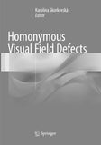 Homonymous Visual Field Defects