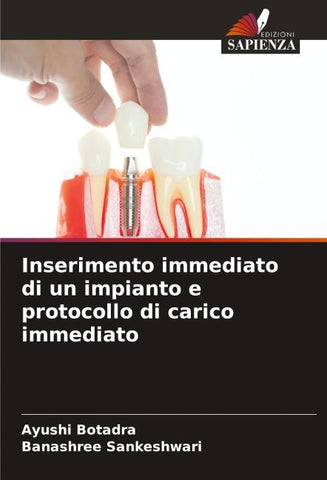 Inserimento immediato di un impianto e protocollo di carico immediato