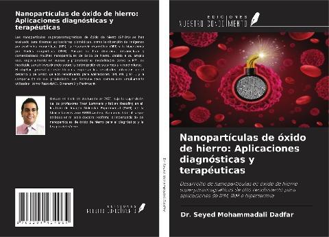 Nanopartículas de óxido de hierro: Aplicaciones diagnósticas y terapéuticas