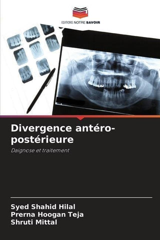 Divergence antéro-postérieure