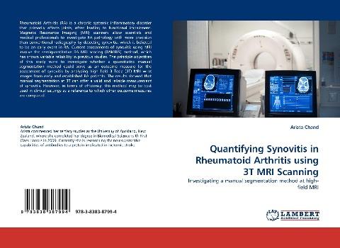 Quantifying Synovitis in Rheumatoid Arthritis using 3T MRI Scanning