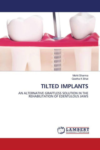 Tilted Implants