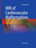 MRI of Cardiovascular Malformations