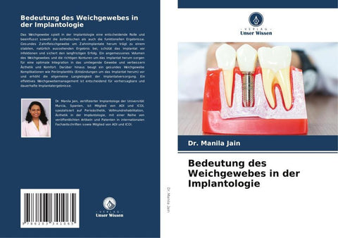 Bedeutung des Weichgewebes in der Implantologie