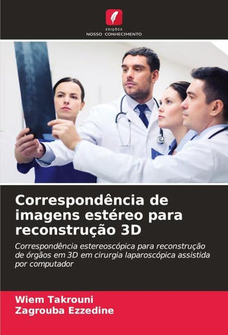 Correspondência de imagens estéreo para reconstrução 3D