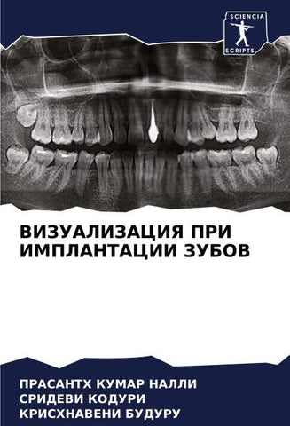 VIZUALIZACIYa PRI IMPLANTACII ZUBOV