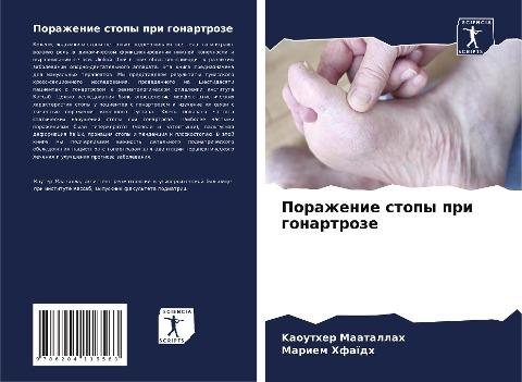 Porazhenie stopy pri gonartroze