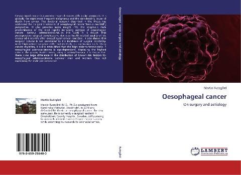 Oesophageal cancer