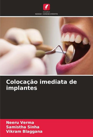 Colocação imediata de implantes