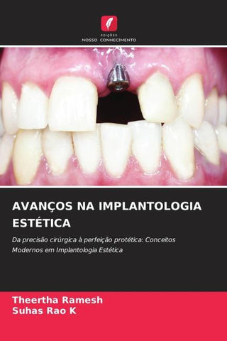 AVANÇOS NA IMPLANTOLOGIA ESTÉTICA