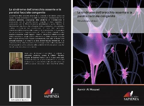 La sindrome dell'orecchio assente e la paralisi facciale congenita