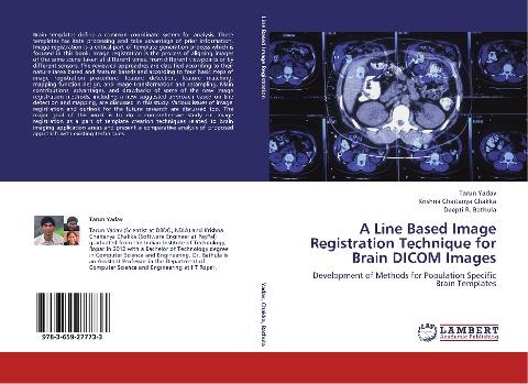 A Line Based Image Registration Technique for Brain DICOM Images