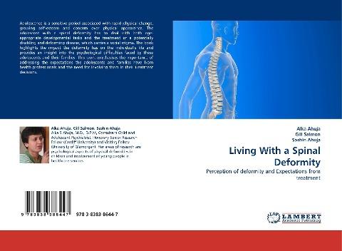 Living With a Spinal Deformity