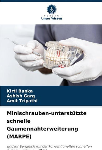 Minischrauben-unterstützte schnelle Gaumennahterweiterung (MARPE)