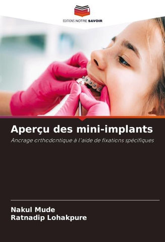 Aperçu des mini-implants