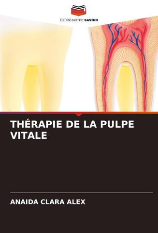 THÉRAPIE DE LA PULPE VITALE