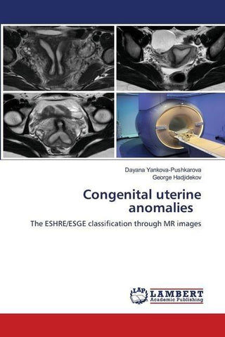 Congenital uterine anomalies