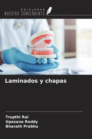 Laminados y chapas