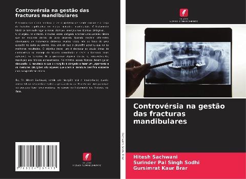 Controvérsia na gestão das fracturas mandibulares