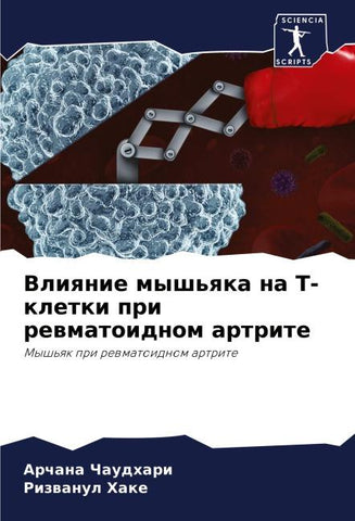 Vliqnie mysh'qka na T-kletki pri rewmatoidnom artrite