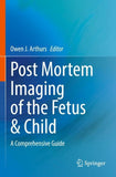 Post Mortem Imaging of the Fetus & Child