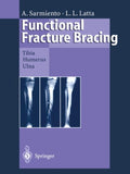 Functional Fracture Bracing