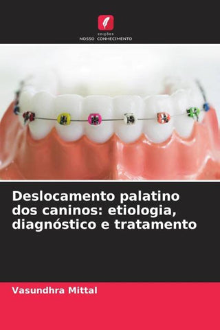 Deslocamento palatino dos caninos: etiologia, diagnóstico e tratamento