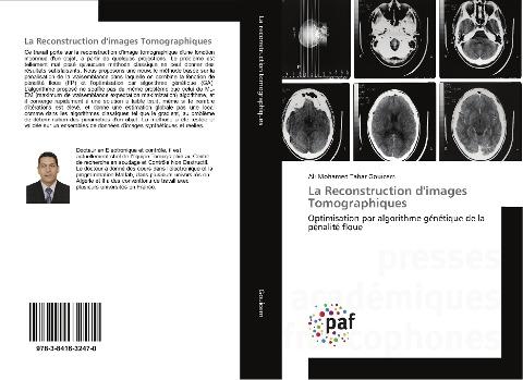 La Reconstruction d'images Tomographiques