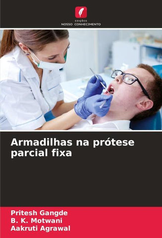 Armadilhas na prótese parcial fixa