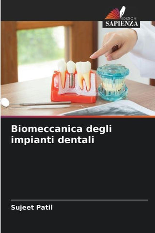 Biomeccanica degli impianti dentali