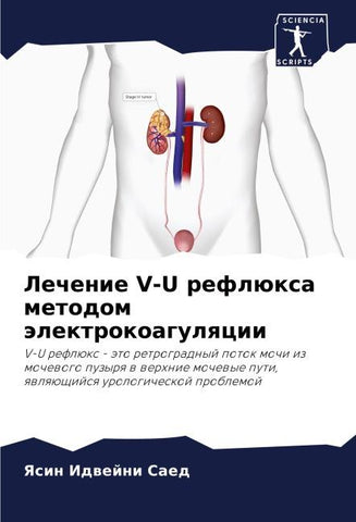 Lechenie V-U reflüxa metodom älektrokoagulqcii