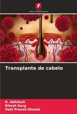 Transplante de cabelo