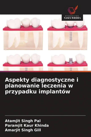 Aspekty diagnostyczne i planowanie leczenia w przypadku implantów