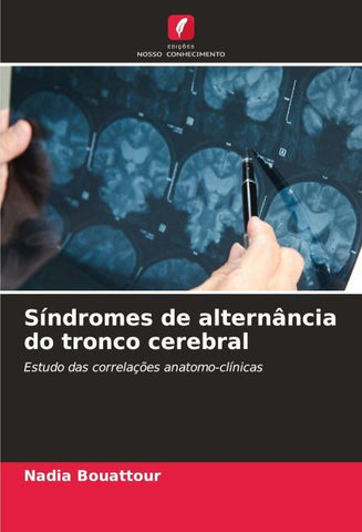 Síndromes de alternância do tronco cerebral