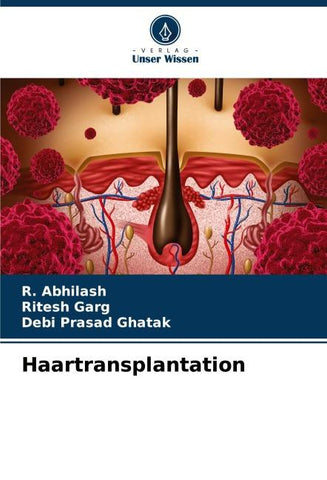 Haartransplantation