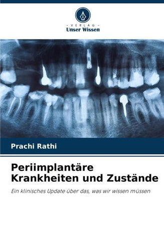 Periimplantäre Krankheiten und Zustände