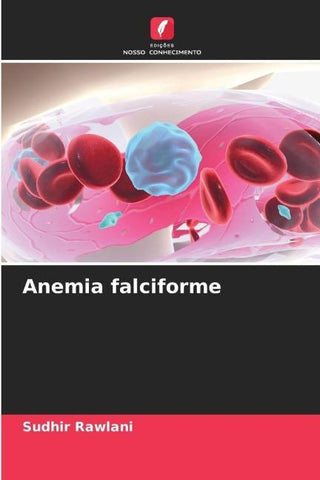 Anemia falciforme