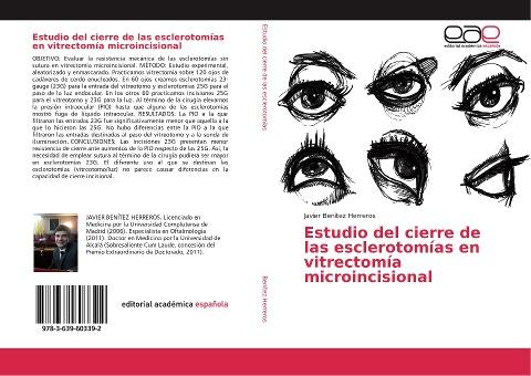 Estudio del cierre de las esclerotomías en vitrectomía microincisional