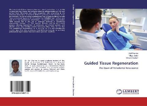 Guided Tissue Regeneration