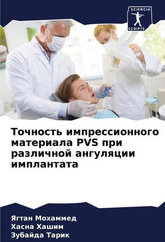 Tochnost' impressionnogo materiala PVS pri razlichnoj angulqcii implantata