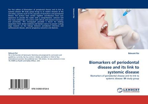 Biomarkers of periodontal disease and its link to systemic disease