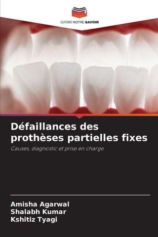Défaillances des prothèses partielles fixes