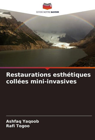 Restaurations esthétiques collées mini-invasives