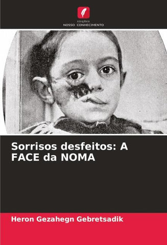 Sorrisos desfeitos: A FACE da NOMA