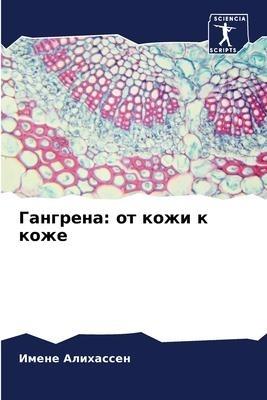 Gangrena: ot kozhi k kozhe