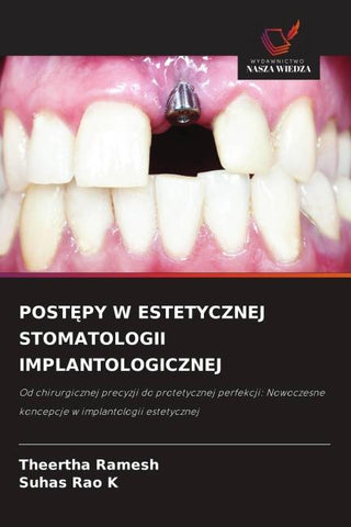 POST¿PY W ESTETYCZNEJ STOMATOLOGII IMPLANTOLOGICZNEJ