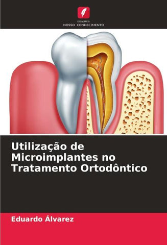 Utilização de Microimplantes no Tratamento Ortodôntico