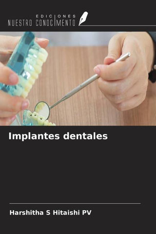 Implantes dentales