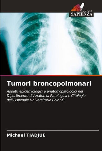 Tumori broncopolmonari