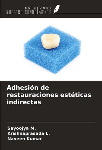 Adhesión de restauraciones estéticas indirectas